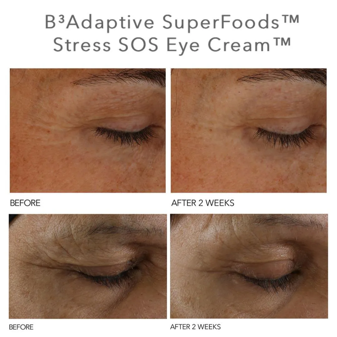 SOS eye cream (5ml)